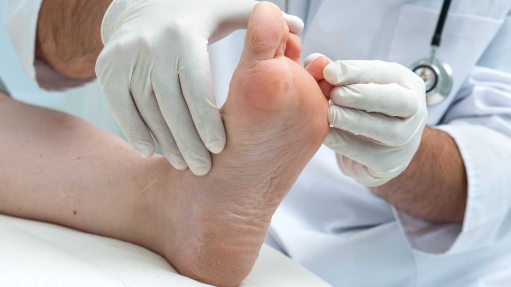 médico revisando un pie de atleta